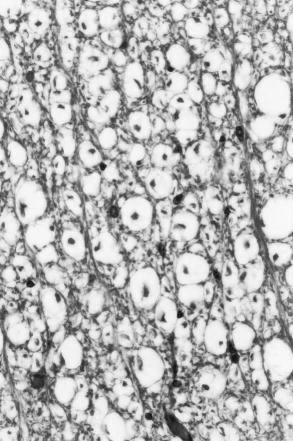 Morfologia da medula espinhal de cães 387 O corte transversal da substância branca da medula espinhal revelou axônios com diferentes