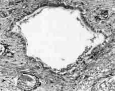 2A). Em relação às células da neuróglia, observou-se que as células ependimárias apresentaram-se em arranjo epitelial simples, com células