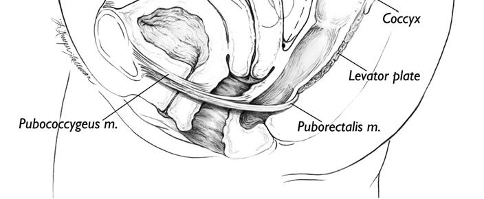 Anatomia funcional Disfunção Prato elevador, hiato urogenital (UGH), e eixo vaginal na presença de