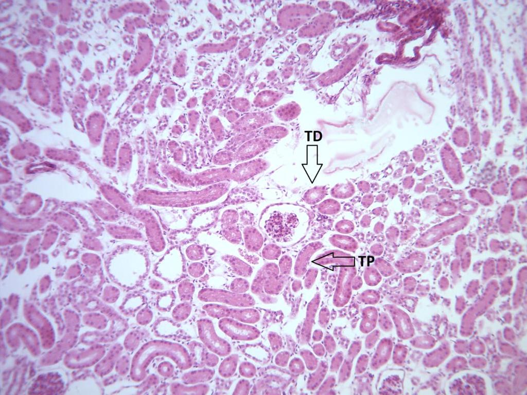 TD: Túbulo Distal; TP: Túbulo Proximal Túbulos e Ductos Coletores A urina passa dos túbulos contorcidos distais para os túbulos coletores, que desembocam