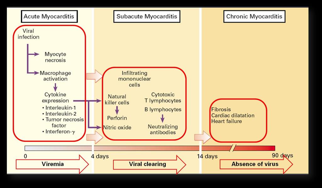 Fisiopatologia da Miocardite - Evolução da