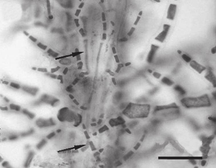 5 6 2 cm 100 µm 7 8 10 µm 20 µm 9 10 50 µm 150 µm Fig.