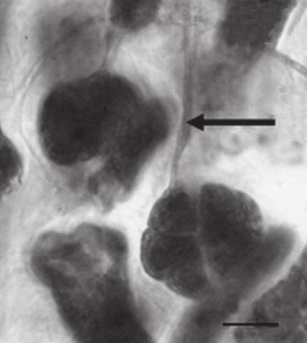 94 familia ceramiaceae 25 26 100 µm 27 20 µm 10 µm 28