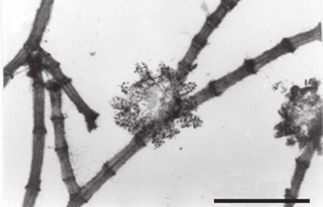 nunes, et al. 97 Centrocerocolax A.B. Joly 1965: 73 Talo em forma de verruga esbranquiçada, esférica ou lobada, parasitando Centroceras clavulatum.