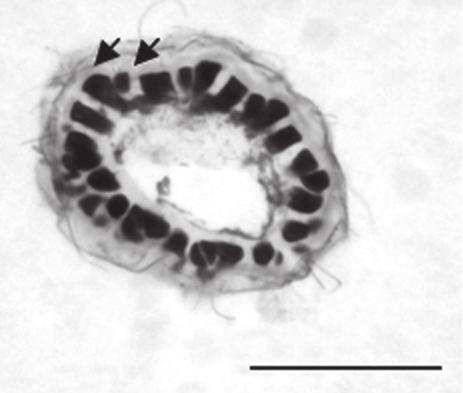 38: Detalhe da organização do nó na porção ereta Fig. 39: Aspecto geral Fig. 40: Aspecto geral do exemplar feminino. Ceramium cimbricum H.E. Petersen in Rosenv. f. flaccidum (H.