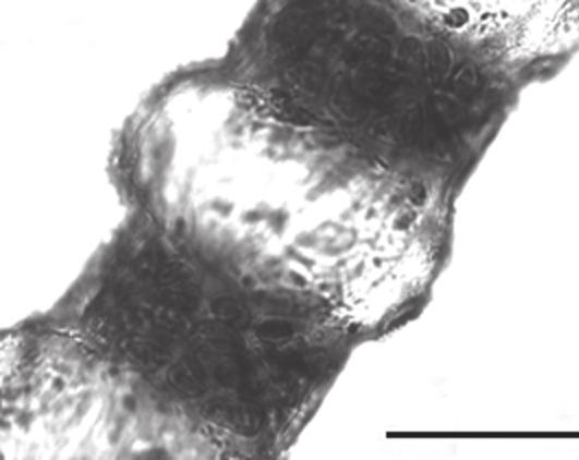 nunes, et al. 111 54 55 100 µm 50 µm Fig. 54: Ceramium deslongchampsii: detalhe do tetrasporângio unilateral Fig. 55: Detalhe da organização do nó Ceramium flaccidum (Kütz.) Ardiss. Nuovo Gior. Bot.