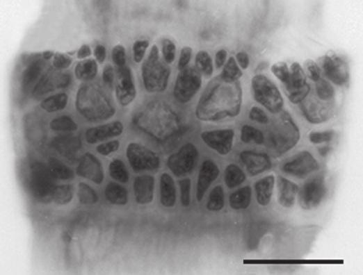 116 familia ceramiaceae 64 65 100 µm 100 µm Fig. 64: Ceramium vagans: aspecto geral do exemplar feminino Fig. 65: Detalhe da organização do nó na porção ereta Crouania J.