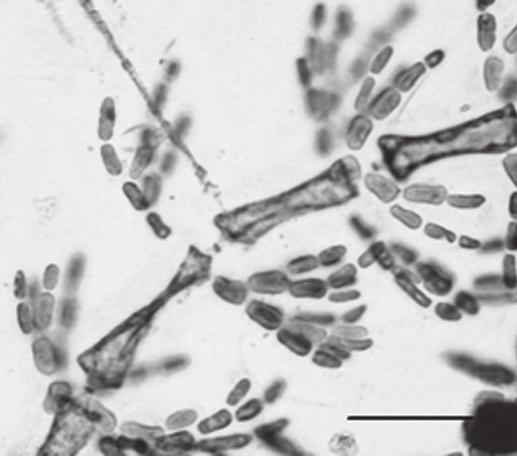 68 69 50 µm 100 µm 70 71 50 µm 50 µm Fig. 68: Crouanophycus latiaxis: aspecto geral do exemplar masculino Fig.