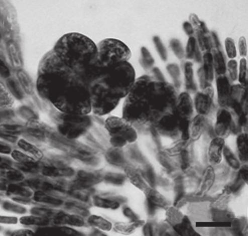 Fig. 72: Crouanophycus latiaxis: desenho esquemático dos