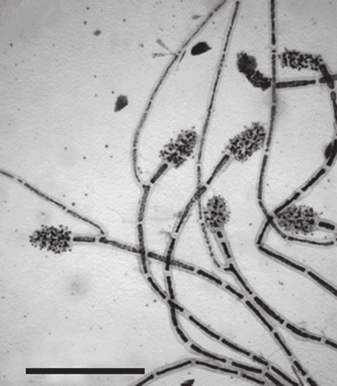 136 familia ceramiaceae 97 98 50 µm 100 µm Fig. 97: Lejolisia mediterranea: ramo carpogonial com tricogine (seta) Fig.