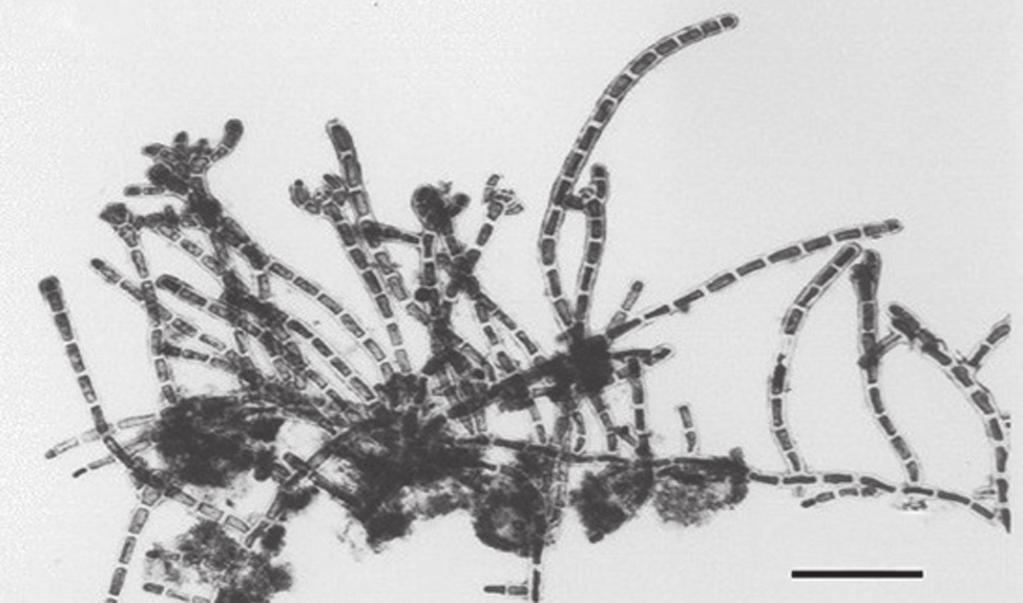 nunes, et al. 137 tetraédricos, sésseis, medindo 50-65 µm, disposos em séries unilaterais nas porções terminais dos eixos eretos.