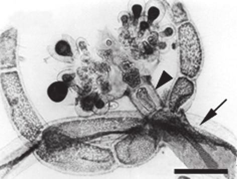 107: Carposporófito, célula hipógina (cabeça