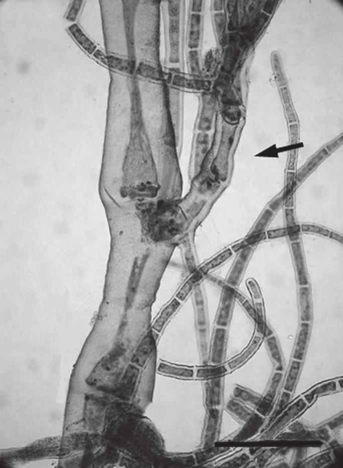 caribaeum (68-69 µm de diâmetro). Entretanto, Guimarães (2006) após examinar o material tipo de Pleonosporium polystichum verificou que este não pode ser separado de P.