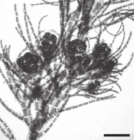 pedunculados Fig.