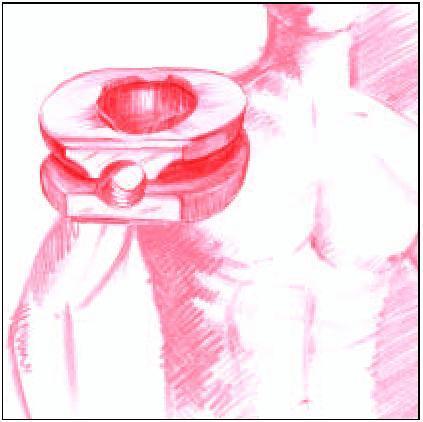 APRESENTAÇÃO / DESCRIÇÃO DO PRODUTO O CESPACE - Família de Implantes para Coluna Vertebral Aesculap é utilizado na restauração da altura dos discos intervertebrais após a retirada de substância