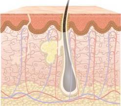 Figura. Estrutura da pele Figura 1. Estrutura da pele A fisiopatogênese da pele sensível não está bem esclarecida.