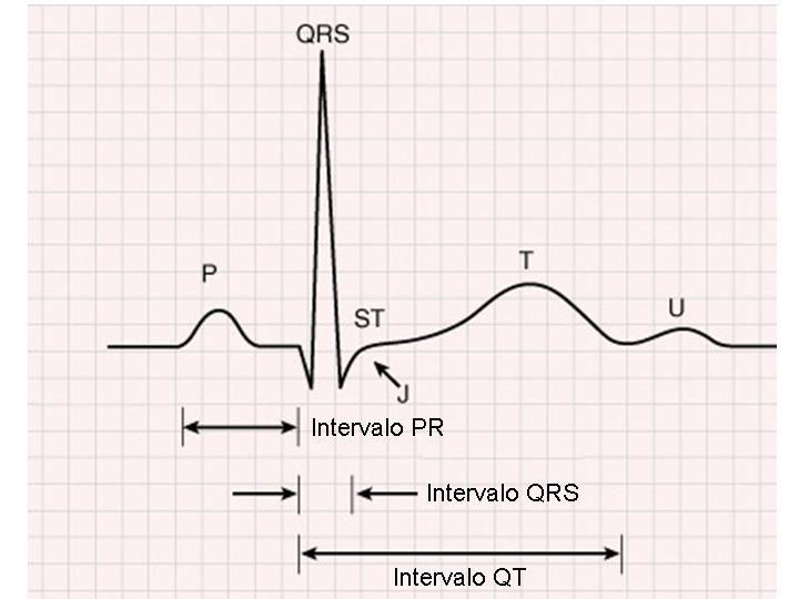 42 Figura 10 O Eletrocardiograma Normal. 5.