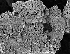 Fragmentos de carvão com traços de decomposição anterior à carbonização: em A, por ataque fúngico (apodrecimento); em B, por ataque de larvas de insetos dos sambaquis.