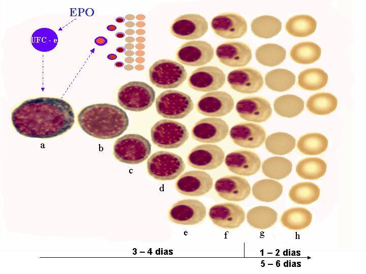 3 sinais de resposta eritropoética compensatória (anemia não regenerativa ou não responsiva).