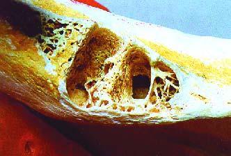 a Figura 3 - Tomógrafo helicoidal com a mandíbula em posição b c d Em seguida, os dentes foram cuidadosamente removidos e, no fundo do alvéolo das raízes mesial e distal, confeccionaram-se cavidades