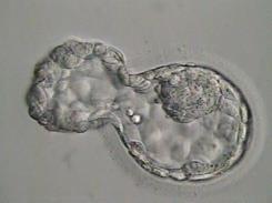 pressão interna do embrião sobre a ZP: mitoses contínuas produção de liquido contração e relaxamento do embrião (pulso de pressão) produção de enzimas