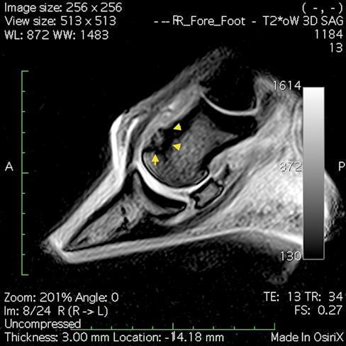 com proliferação endosteal, remodelação cortical e hiperintensidade de sinal (gentilmente cedida pela Clinica Equina San Biagio).