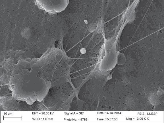 As imagens mostram uma estrutura de fibras contendo inúmeros defeitos como contas e má formação de fibras.