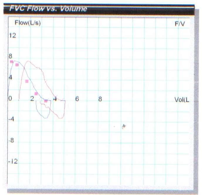 1) Medição de fluxo em L/s 2) Medição do volume de ar 3) Fluxo: valores previstos 4) Desempenho da curva pré BD 5) Desempenho da curva pós
