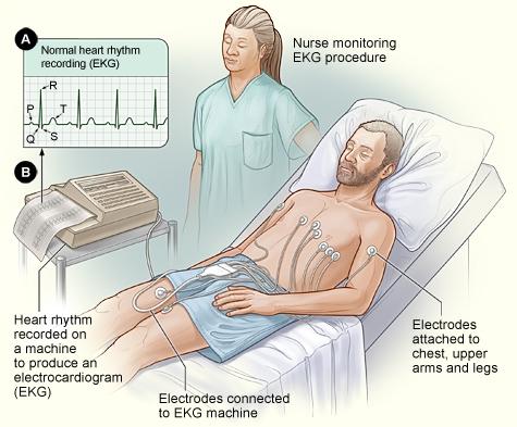Monitoramento de Arritmia Eletrocardiograma