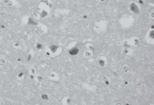 herpesvírus bovino-5. Fig.9.