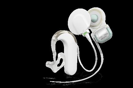 Sistema de implante eletroacústico SYNCHRONY EAS A Estimulação eletroacústica (EAS) é uma solução potencial para surdez parcial, também conhecida como perda auditiva de altas frequências.