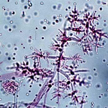 T. harzianum Habilidade em crescer sob diferentes concentrações de Mn, Zn, Cu e Fe; Consegue solubilizar esses micronutrientes por meio da acidificação do meio (H + ) ou liberando