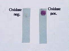 Prova da oxidase Interpretação do