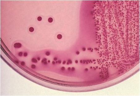 Testes Metabólicos Enterobacteriaceae (Gram ) A- Escherichia,