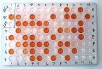 (capaz de produzir linfoma e quadros neurológicos