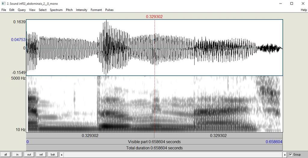 81 As configurações das espectrogramas serviram para uma boa visualização dos segmentos produzidos pelos falantes para