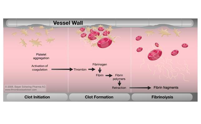 Fibrinólise Restauro do fluxo sanguíneo através da dissolução da fibrina Células endoteliais de