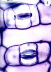 de tamanhos diferentes Anomoc ítico: envolvido por um número variável de células que não se diferem em formato e