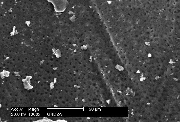 (eletromicrografia do grupo 3) Fig.4 Smear layer parcialmente removida.