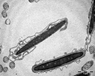 68 * A B C D * E F Figura 1 - Ultraestrutura de espermatozoides de reprodutores