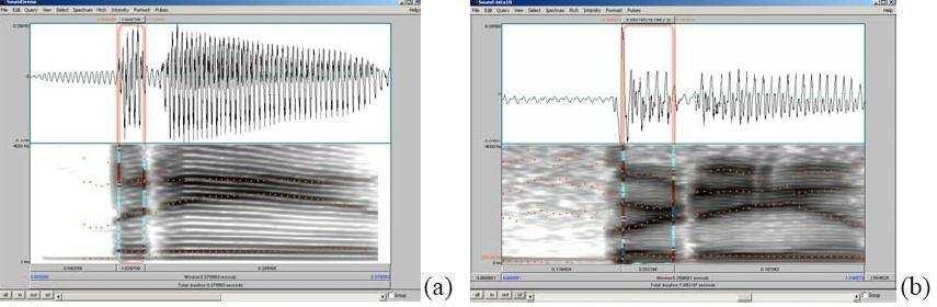 No entanto, no sujeito que está em tratamento de reabilitação fonoaudiológica, essa vogal tem uma duração maior do que a esperada para a fala normal (Fig. 13, quadros (b) e (a), respectivamente).