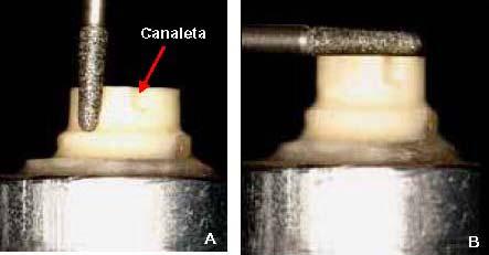 Cada preparo dentário recebeu duas camadas de espaçador (20µm) e com o auxilio de um gotejador PKT nº1 aquecido na chama do bico de Bunsen, procedeu-se ao enceramento dos copings diretamente sobre