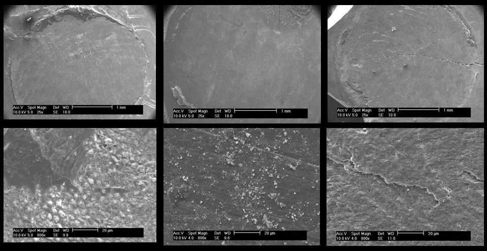 50 G1 (25X) G2 (25X) G3 (25X) G1 (800X) G2 (800X) G3 (800X) Figura 4: Micrographs (SEM) of the areas of specimens of the groups G1 (ARC RelyX and Single Bond), G2 (RelyX Unicem) and G3 (RelyX Unicem