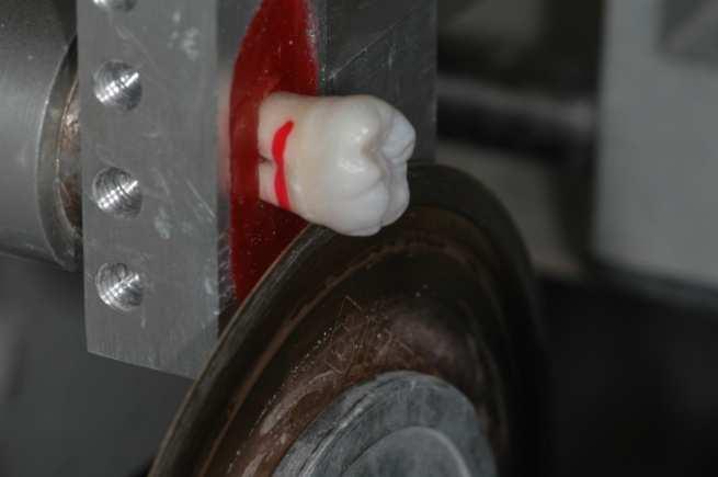 Figura 2: Dente fixo com cera pegajosa ao dispositivo da máquina de