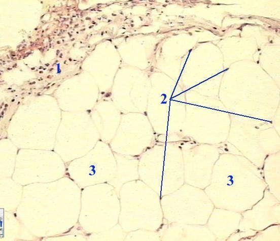 Tecido adiposo unilocular 1 - Tecido Conjuntivo 2 - Núcleos