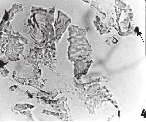 205 X Figura 3 Fotomicrografia das brânquias de peixe submetido ao flúor 5 ppm, observam-se células mucosas fortemente alcian-blue-reativas (setas largas). Reação: A.B. ph 2,5.