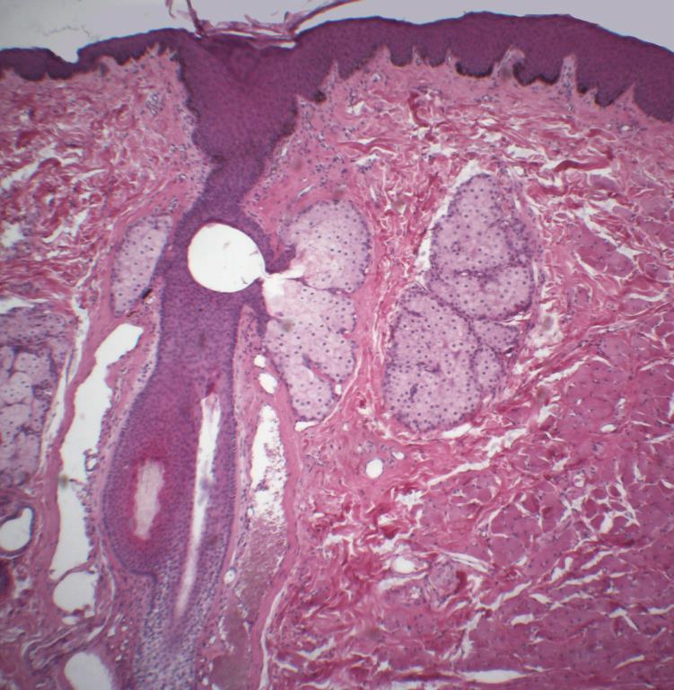 18 Mucosa de transição Tecido epitelial de revestimento estratificado pavimentoso Mucosa de revestimento Tecido epitelial de revestimento estratificado