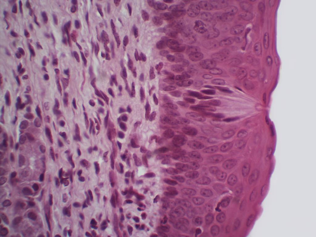 22 Mucosa especializada da língua Botões ou corpúsculos gustativos Figura