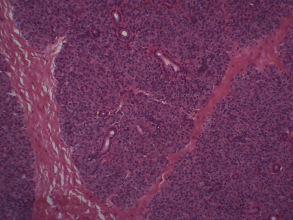 51 Septo interlobular Ducto estriado Lóbulos glandulares acúmulo de adenômeros