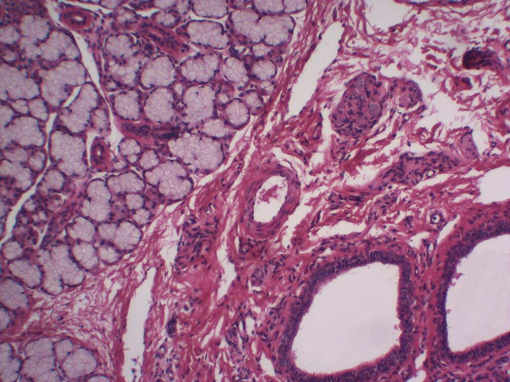 Lóbulo Septo interlobular Ducto interlobular Ducto extra lobular, interlobular ou excretor Ácino mucoso